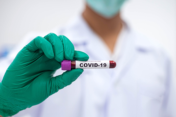 Pachete Serologice SARS-COV-2 post imunizare