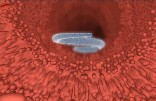 7 remedii naturale contra parazitilor intestinali Un preparat pentru îndepărtarea viermilor la om