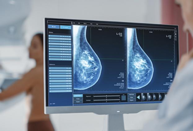 Povești care vindecă. Decizia unei mastectomii radicale, după 5 ani de ezitări