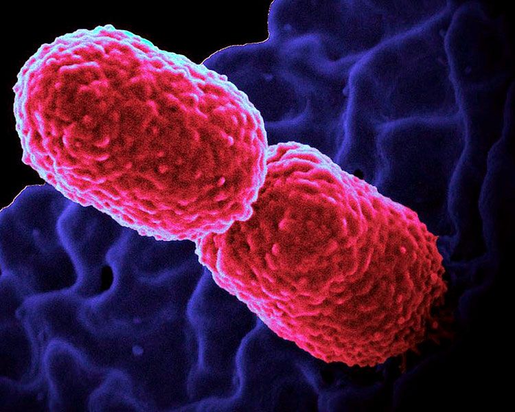 Care este legatura dintre bacteriile orale si boala inflamatorie intestinala?