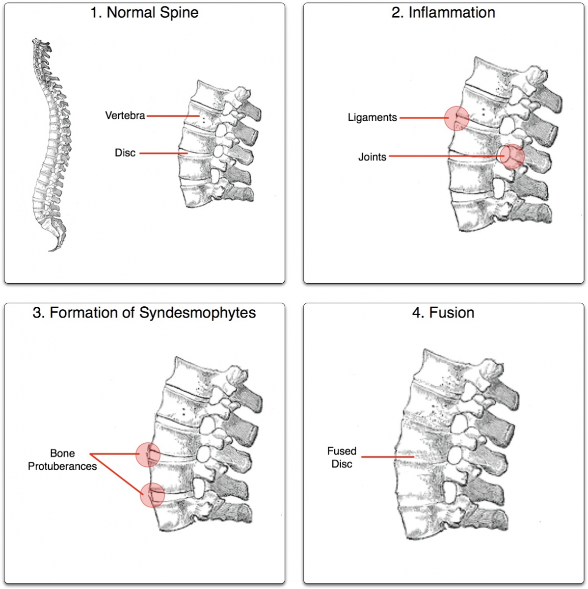 diagnosticarea durerii în articulația cotului durere la nivelul piciorului și articulațiilor