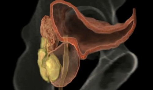 simptome de erectie a prostatitei potența nu există erecție