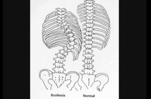 plante medicinale pentru tratamentul articulațiilor și coloanei vertebrale condroprotectoare pentru artrita articulației încheieturii