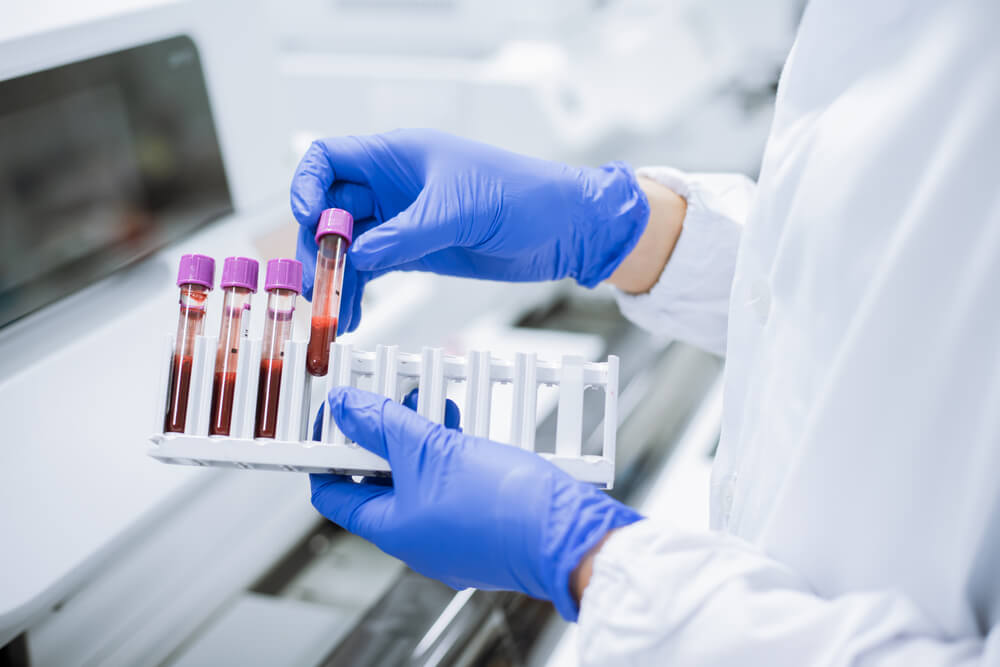 Analize de sânge frecvente - De ce sunt importante și ce afecțiuni pot depista | MedLife