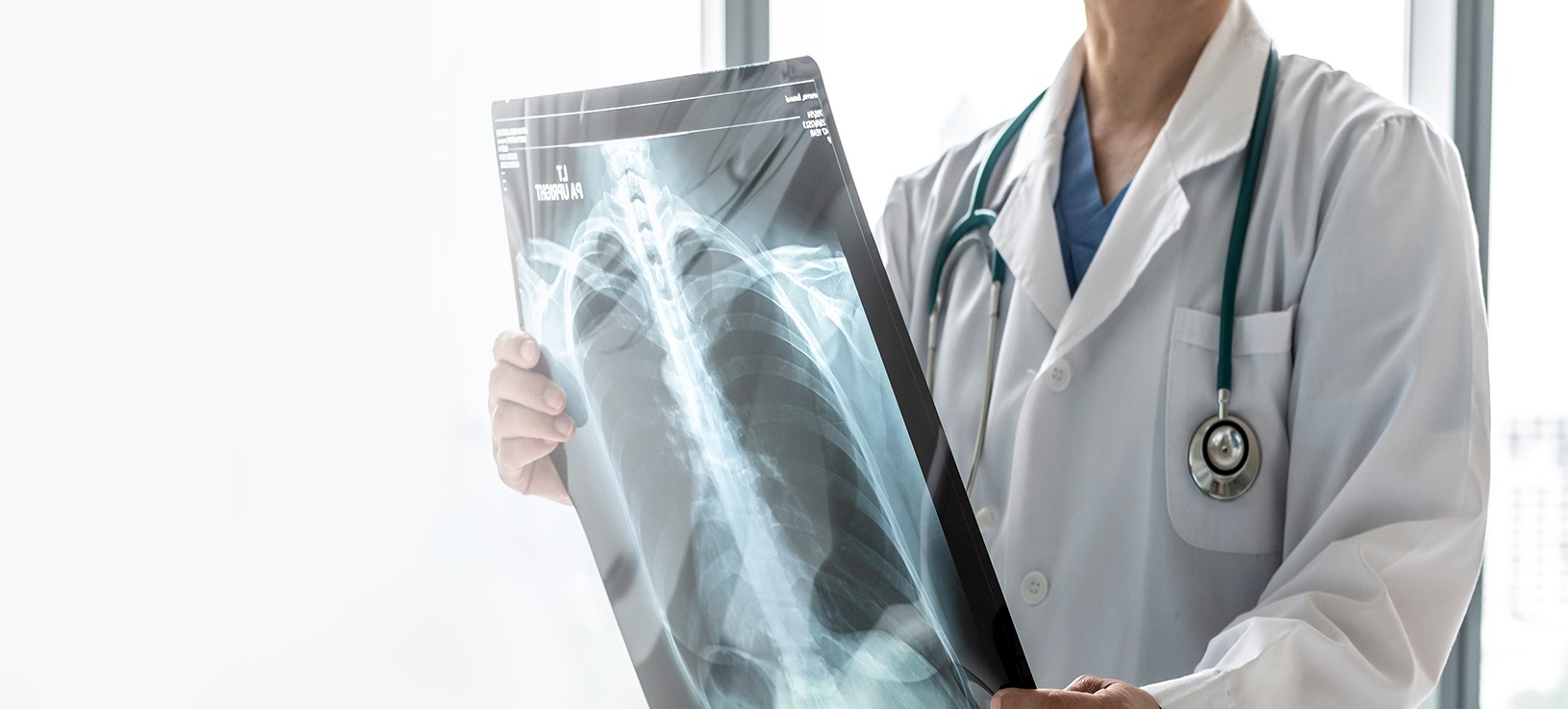 Monitorizare CT post-COVID