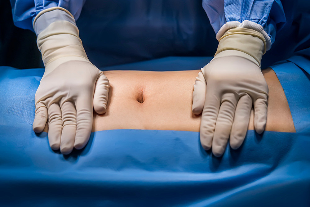 Eventratia: cauze, simptome, tratament | MedLife