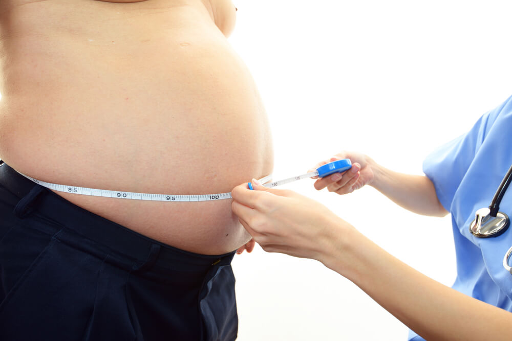 tratamentul chirurgical al obezitatii