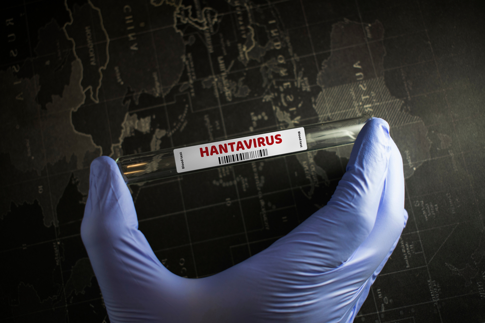 Eprubeta cu test pentru hantavirus