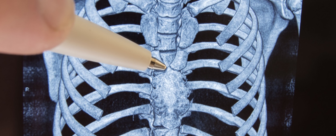 Timus Insec Timus: functii, rol, importanta pentru organism | MedLife