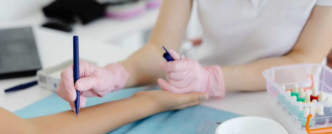 Doctor efectuand un test de alergie cutanata pe pielea unui pacient cu pielea alba