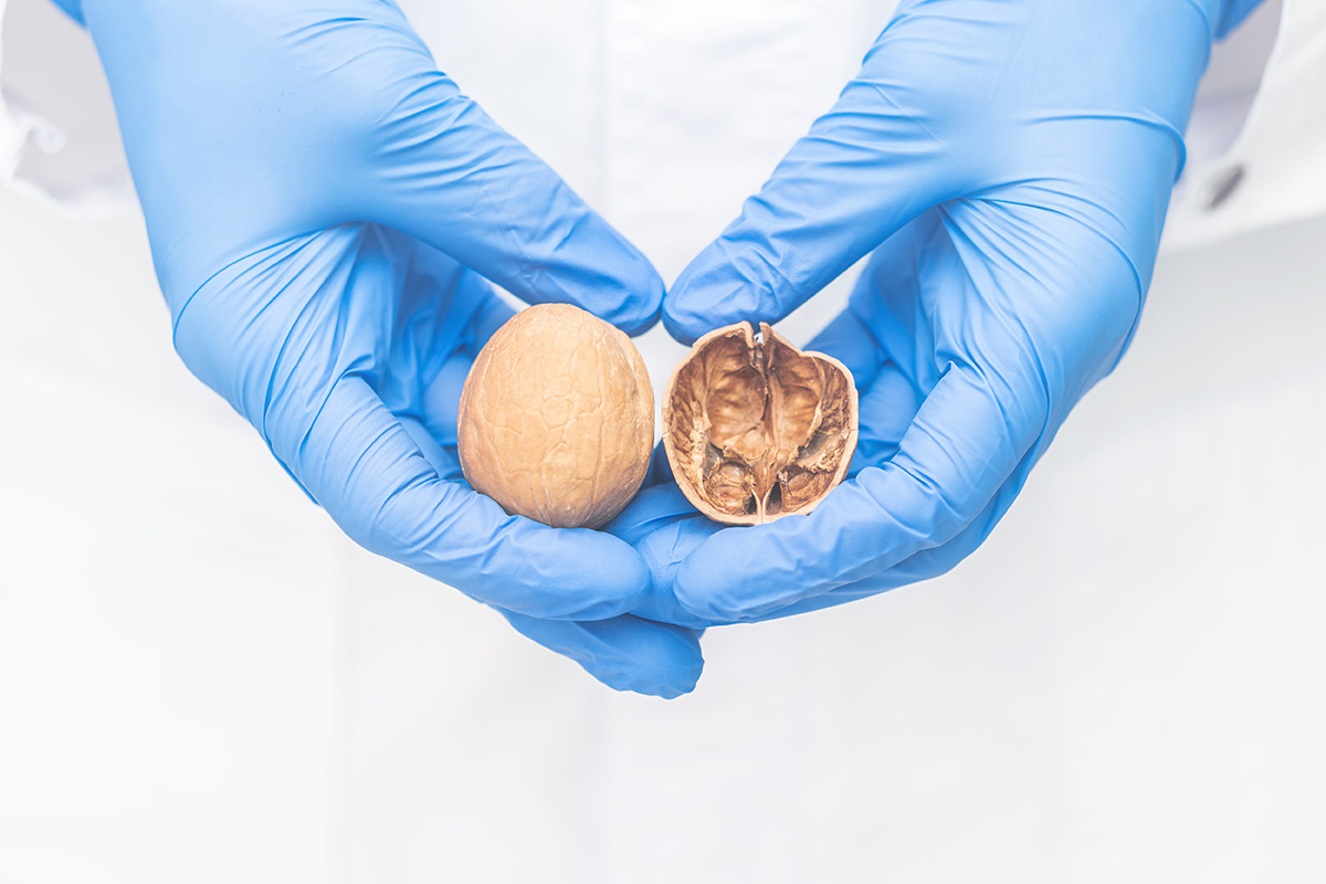 Cancerul testicular: simptome, diagnostic și tratament | MedLife