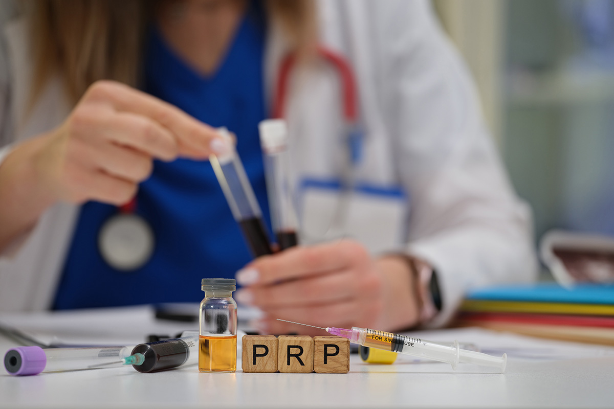 Mostre PRP pentru tratament.