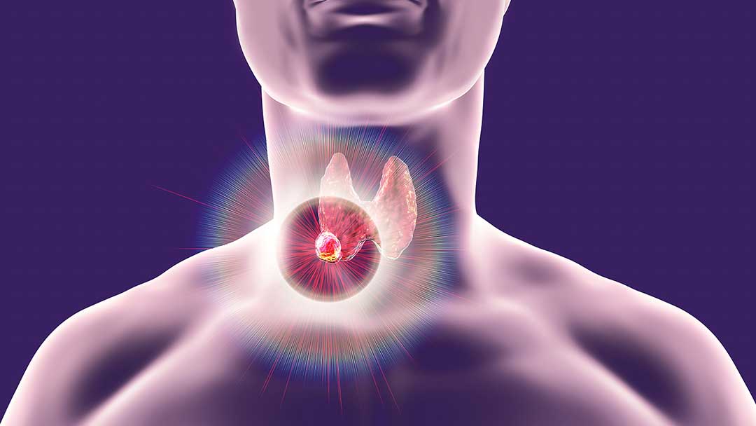 Tehnici chirurgicale pentru boli endocrine complexe