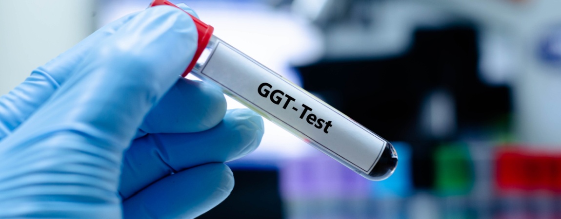 Tub de proba de sange pentru analiza GGT gama glutamil transferaza in laborator medical.