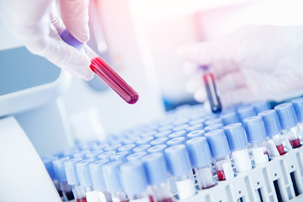 Medic specialist pregatind probe de sange pentru analize medicale.