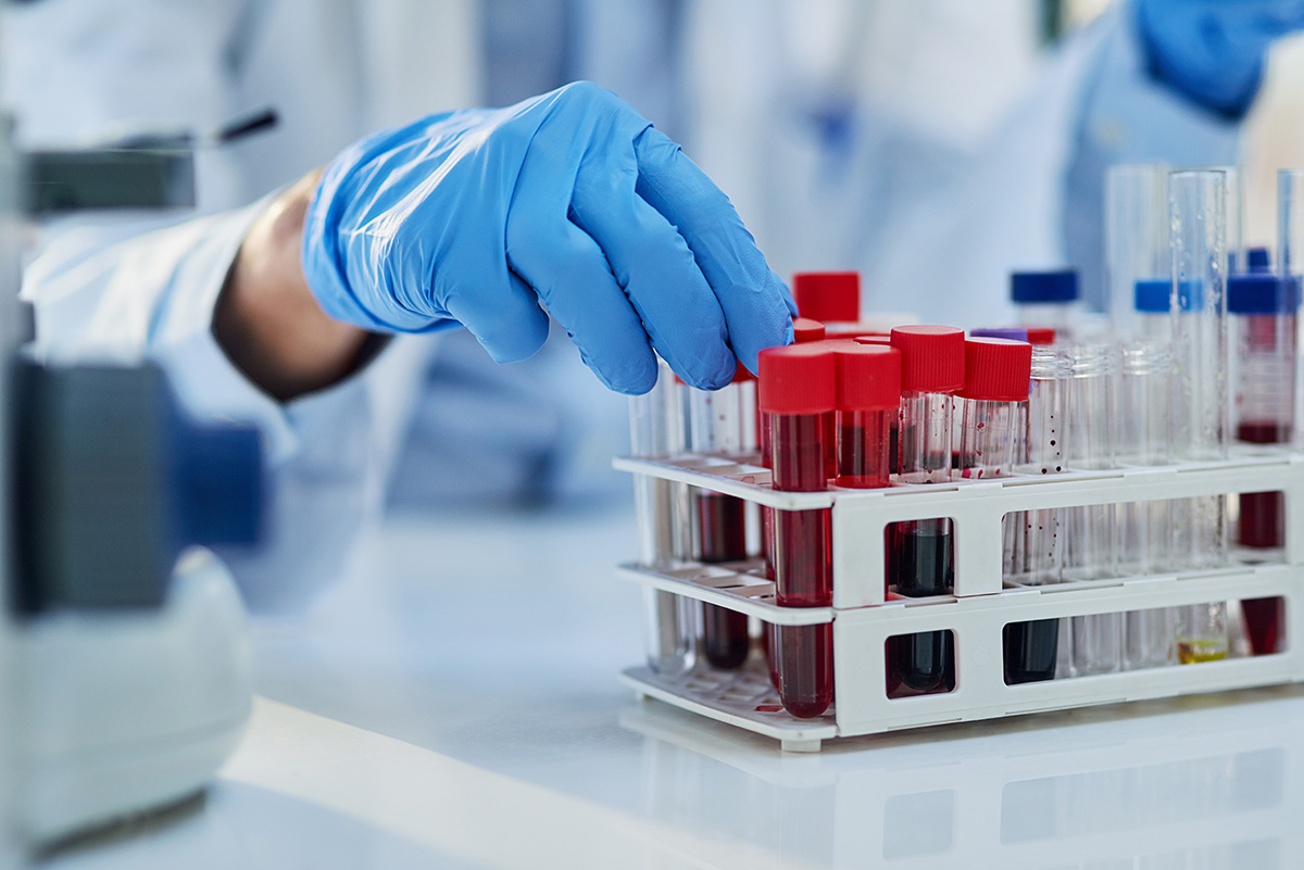 Tehnician de laborator manipuland o proba de sange pentru analiza, ilustrand procesul de testare medicala si investigatiile de laborator.