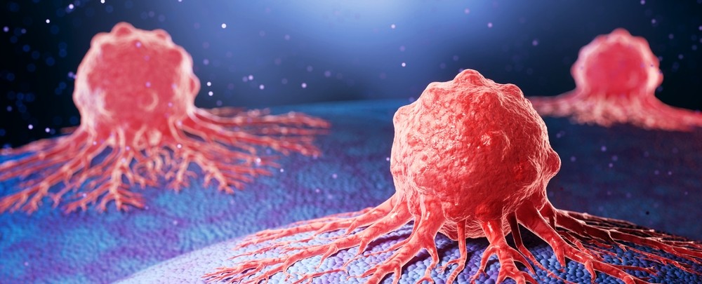Ilustratie 3D a celulelor canceroase dezvoltate pe tesut uman