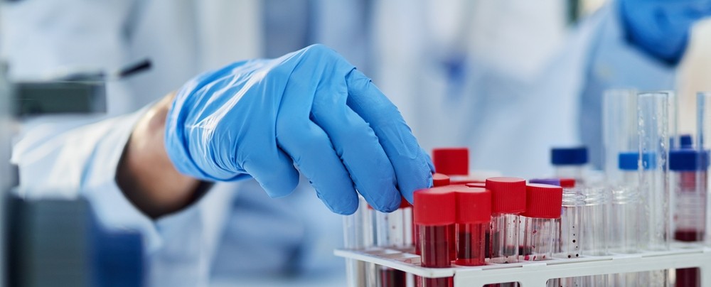 Mana tinand o proba de sange pentru analiza medicala in laborator