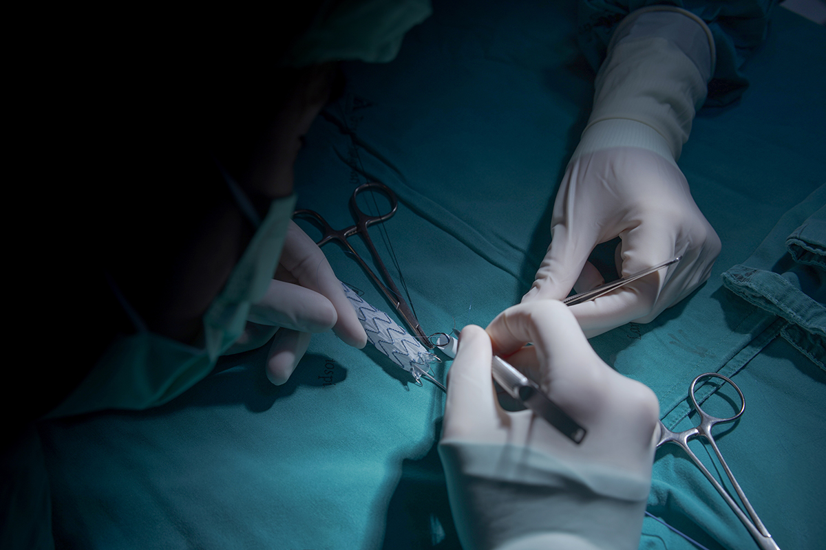 Chirurg vascular efectueaza o interventie minim invaziva asupra vaselor de sange