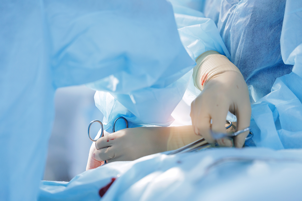 Echipa medicala realizeaza sutura unei incizii in timpul unei interventii chirurgicale abdominale