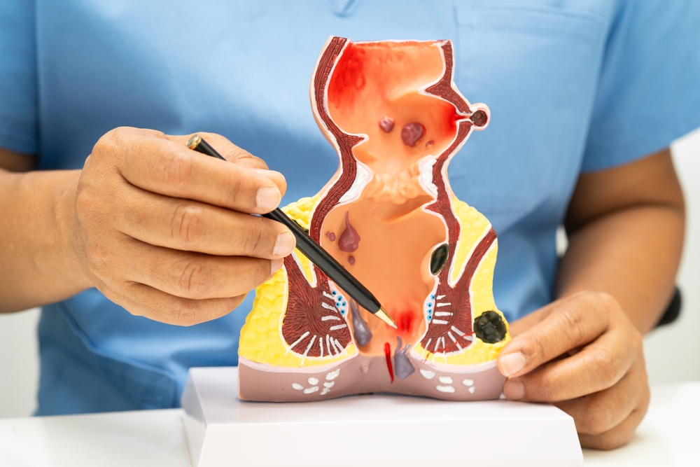 Medic care prezinta anatomia rectului