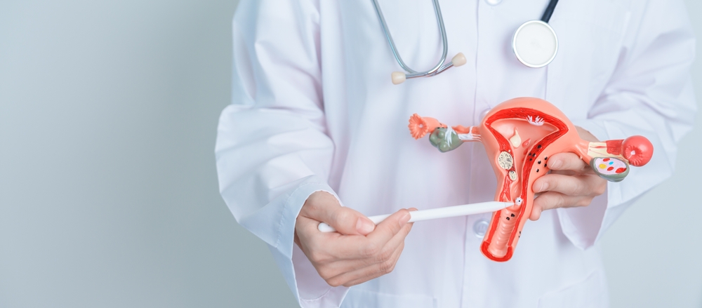 Medic prezinta un model anatomic al uterului si ovarelor in timpul consultatiei