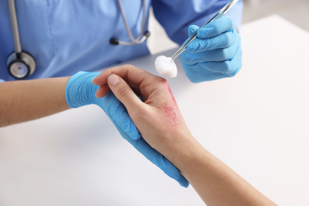 Medic trateaza o arsura la nivelul mainii in timpul unei consultatii medicale