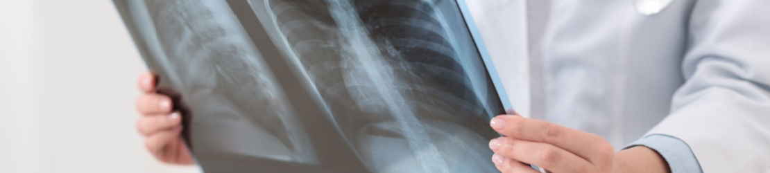 Medic ce tine in mana o radiografie