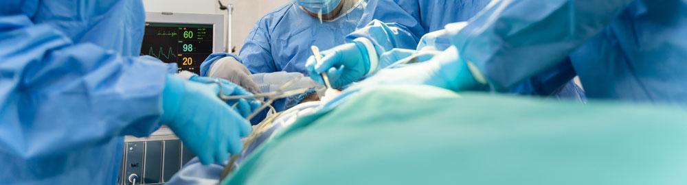 chirurgie oncologica