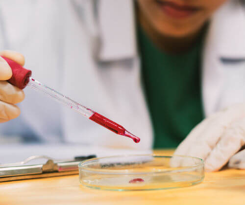 Ce este anemia, cum poate fi depistata si cum se trateaza | MedLife