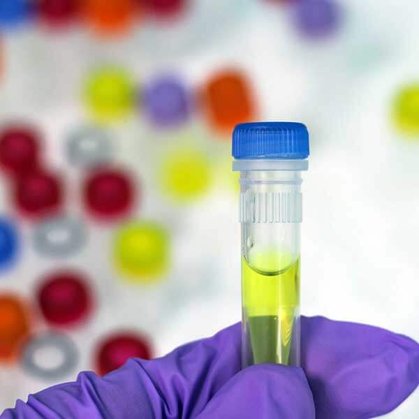 Lyrical Boost Begging Tratament nou pentru Chlamydia cu terapie genetica livrata prin intermediul  nanotehnologiei | MedLife