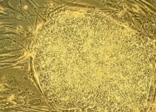 de ce o celula stem intrun embrion uman devine un neuron si nu o celula musculara