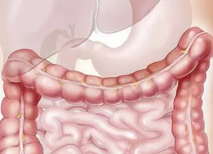 noi date privind legatura dintre sanatatea microbiomului si declansarea obezitatii