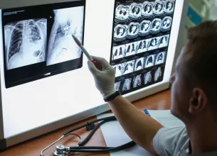 riscul de cancer pulmonar poate fi redus cu 20 prin screening ct