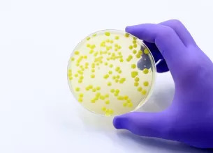 Proba de analliza a unei bacterii infectioase rezistente la antibiotic