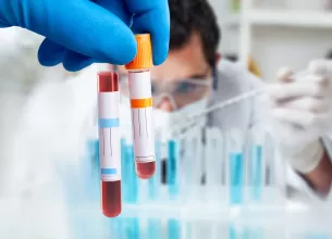 Probe de sange pentru testarea nivelului de progesteron