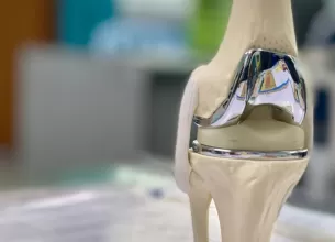 Proteza totala la genunchi, model anatomic