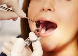 Femeie careia i se administreaza anestezie dentara