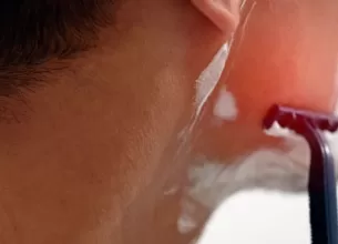 Barbat cu iritatie la ras