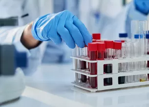 Tehnician de laborator manipuland o proba de sange pentru analiza stiintifica, evidentiind procesul de testare medicala si investigatiile biochimice realizate in clinica.