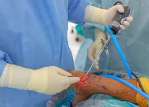 Chirurg ortoped efectuează artroscopie la gleznă la un pacient cu tendinopatie a tendonului lui Achile. 