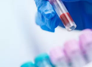 maini cu manusi tin proba de sange pentru analiza veterinara in laborator medical