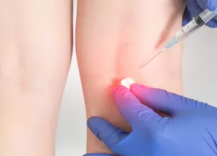 Medic administreaza injectie in articulatia umarului pacientului in cadrul unei proceduri medicale.