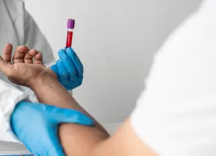 Recoltare de sange pt analize de uree si creatinina inainte de CT