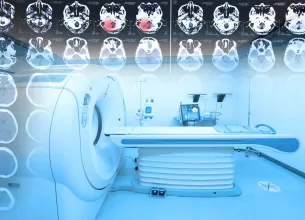 rmn si spectroscopia rm