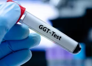 Tub de proba de sange pentru analiza GGT gama glutamil transferaza in laborator medical.