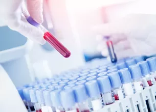 Medic specialist pregatind probe de sange pentru analize medicale.
