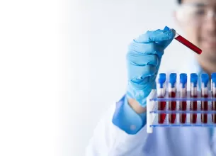 Tehnician tinand o eprubeta cu proba de sange pentru analiza in laborator.