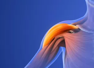 Ilustratie a unei leziuni la umar care provoaca durere musculara