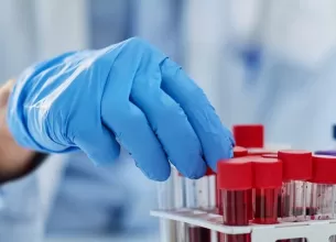 Mana tinand o proba de sange pentru analiza medicala in laborator
